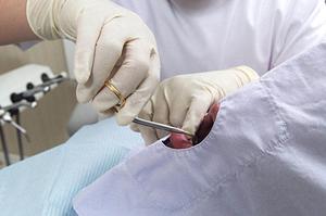 柏市で評判の高いインプラント歯科