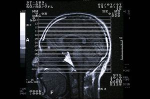 名古屋のマウスピース型矯正歯科専門クリニック – 名駅MA矯正歯科