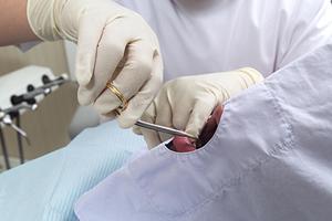 大阪で内視鏡検査を受けて早期発見する